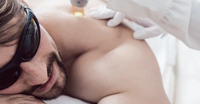 Laser Hair Removal