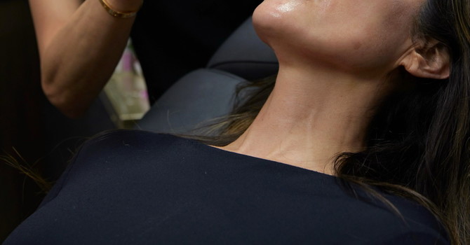 Microneedling