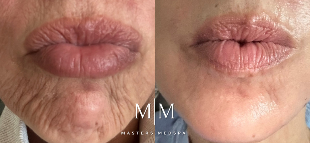 MM_UltraClear_byTannaz_SRamos